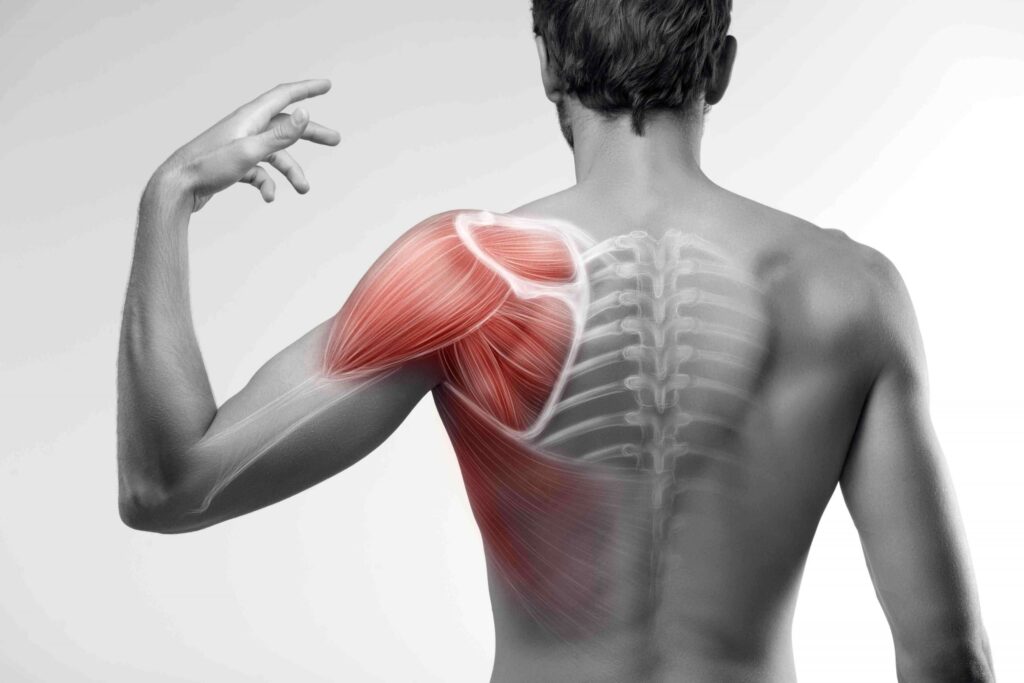 Muscle Tear Treatment in Pune